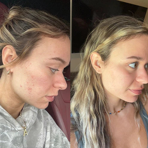 Miracle Tox Perfection Tox Ampoule